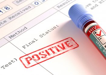 29 persons with HIV died during Abalaka’s treatment –Govt