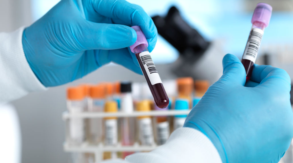 Nigeria records 23 new cases of COVID-19, total now 174