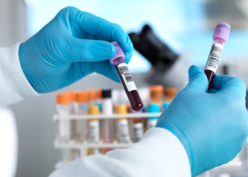 Nigeria records 23 new cases of COVID-19, total now 174